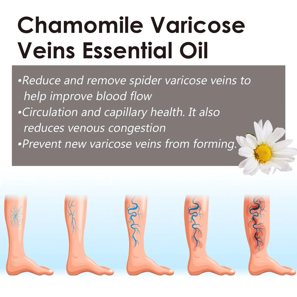 Chamomile leg essential oil bottle containing 10ml of pure chamomile oil for massage