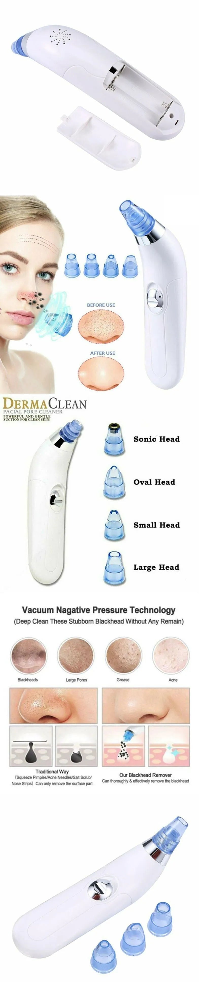 Blackhead Electric Pore Export Blackhead Cleaner in white with ultrasonic vibration function
