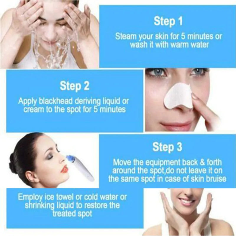 Blackhead Electric Pore Export Blackhead Cleaner in white with ultrasonic vibration function