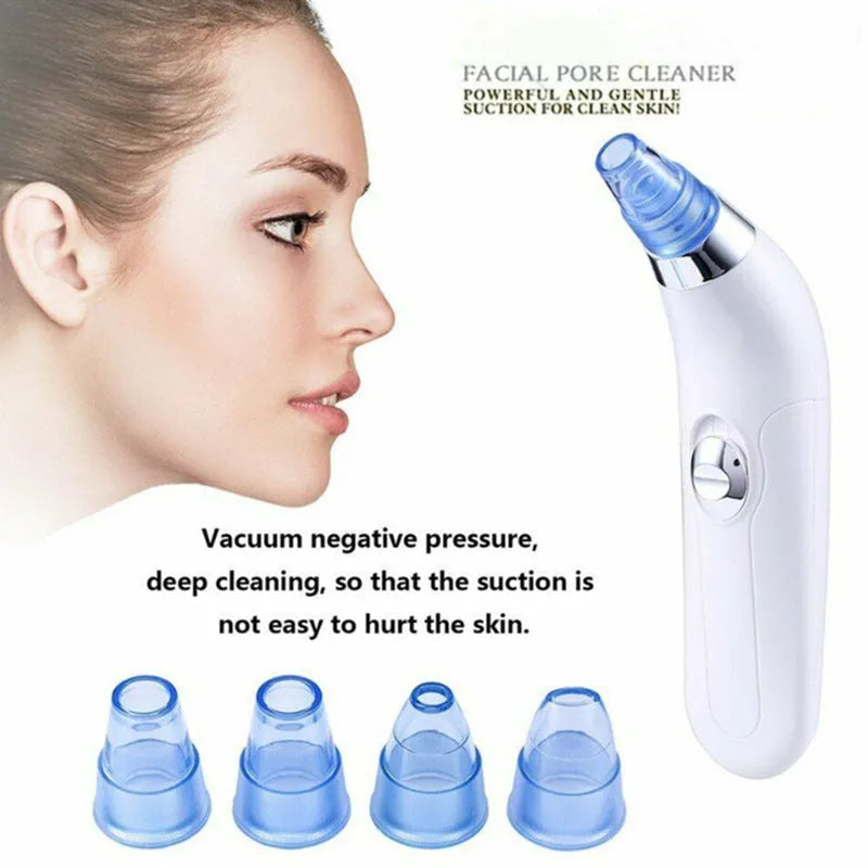 Blackhead Electric Pore Export Blackhead Cleaner in white with ultrasonic vibration function