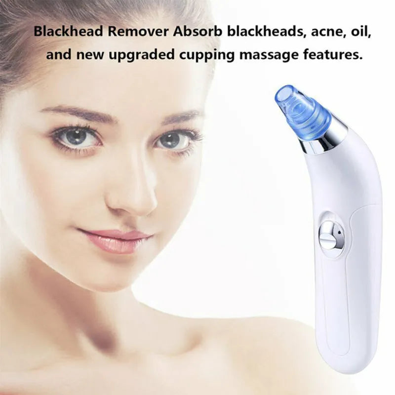 Blackhead Electric Pore Export Blackhead Cleaner in white with ultrasonic vibration function