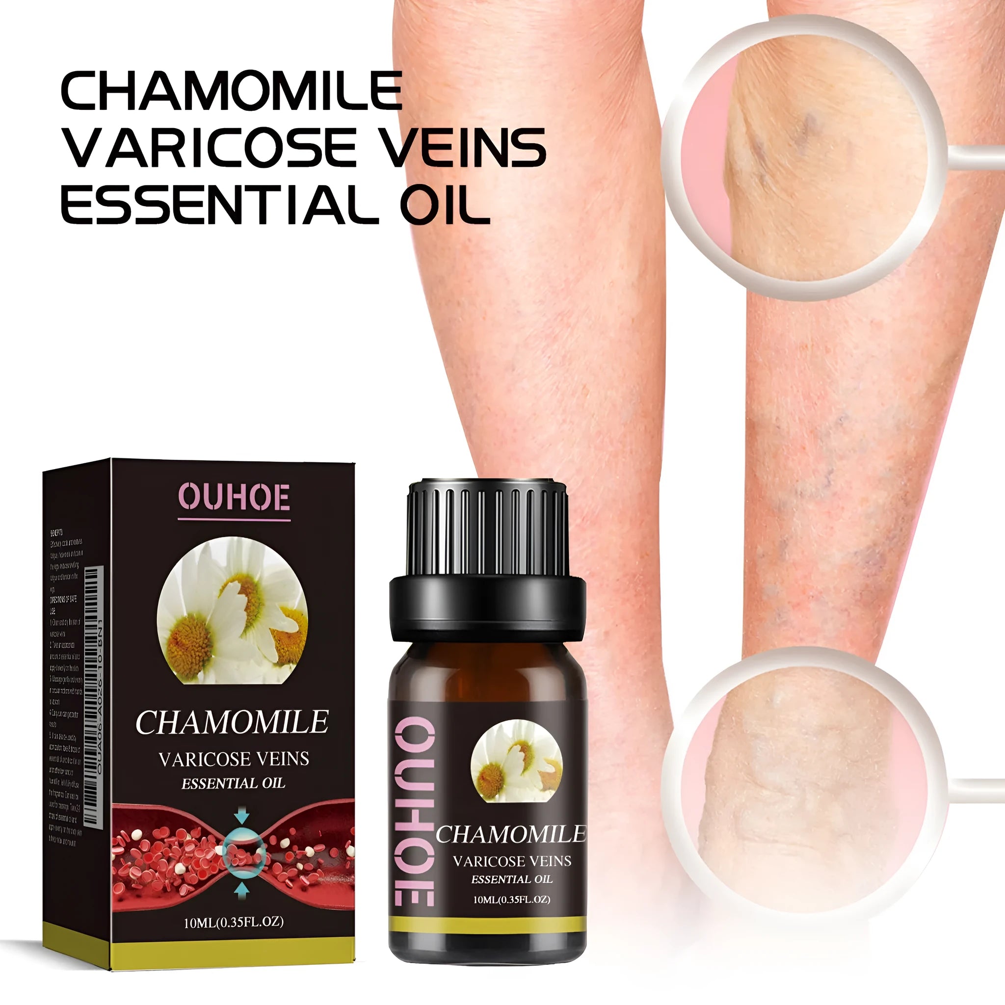 Chamomile leg essential oil bottle containing 10ml of pure chamomile oil for massage