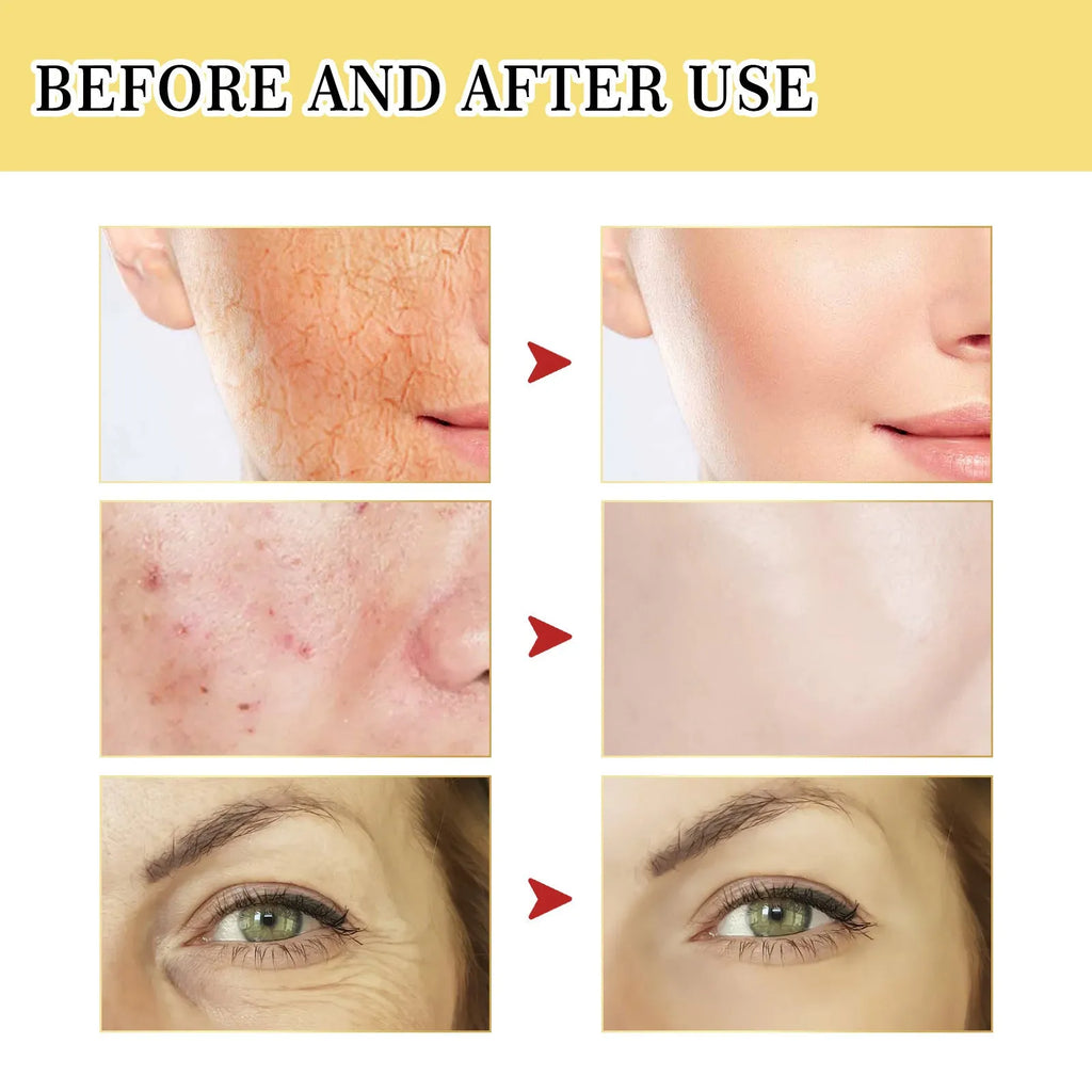 100ml bottle of original snail collagen facial serum for hydrating and brightening skin