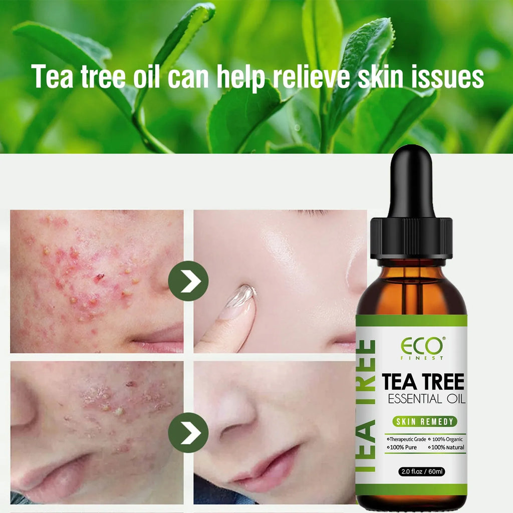 60ml tea tree essential oil bottle for acne treatment and massage