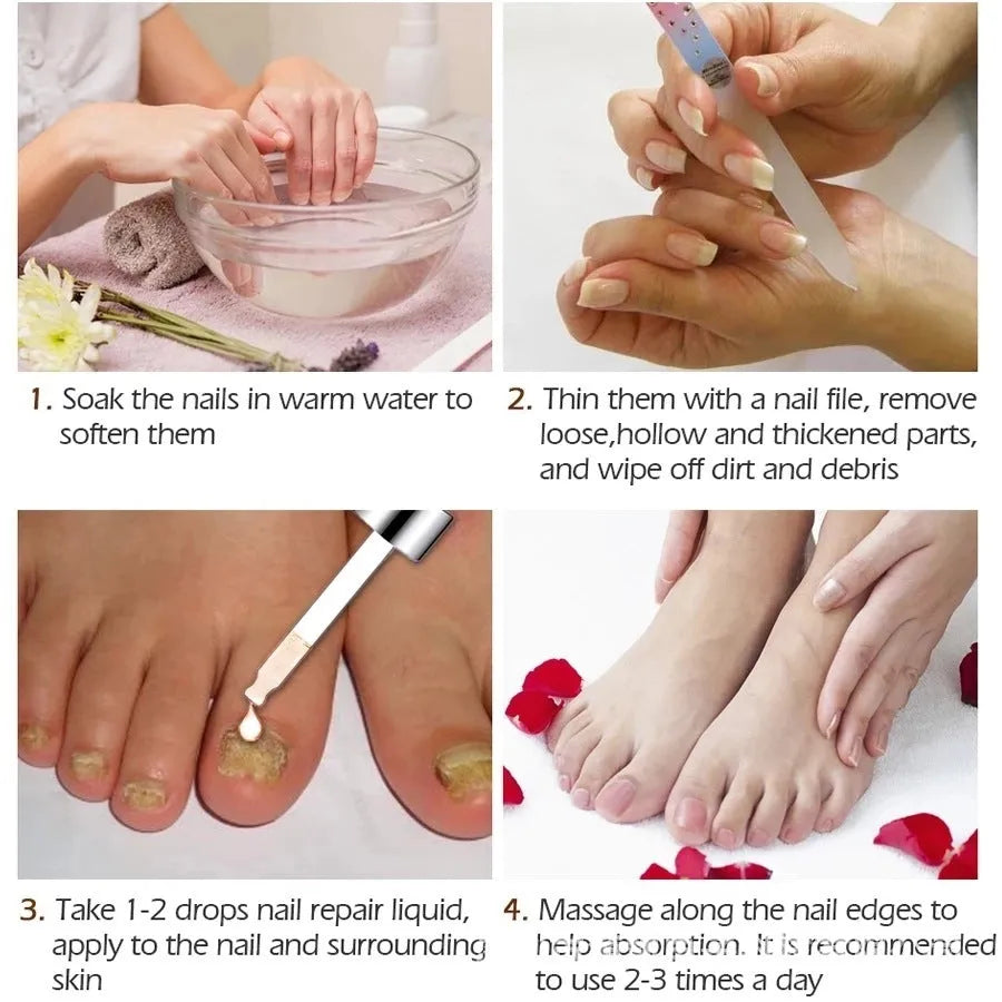 Deck Liquid Antimicrobial Repair Dust 10ml whitening antibacterial foot treatment bottle