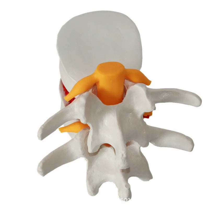 White PVC lumbar disc herniation demonstration model for medical education
