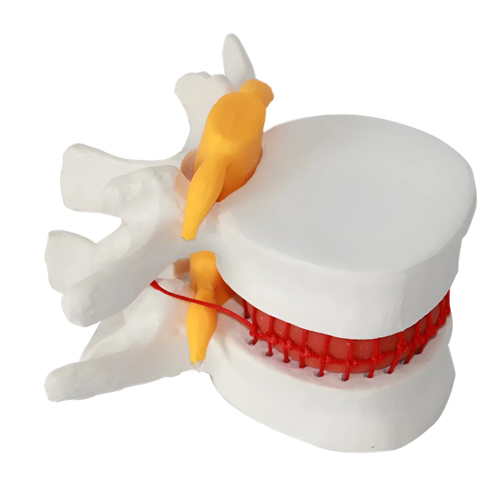 White PVC lumbar disc herniation demonstration model for medical education