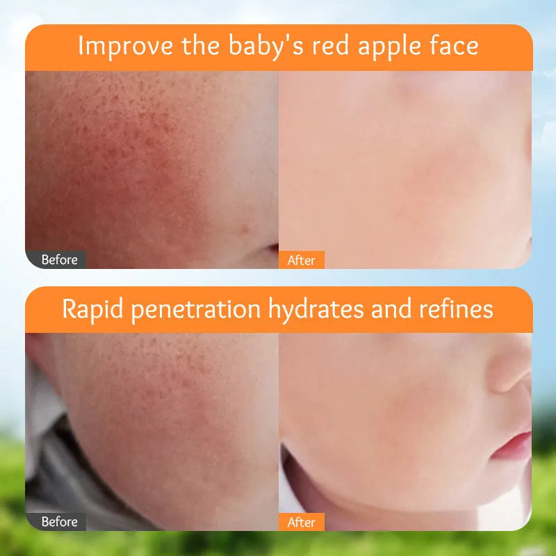 English Marigold Children's Moisturizing Facial Cream 50g tub for universal skin types