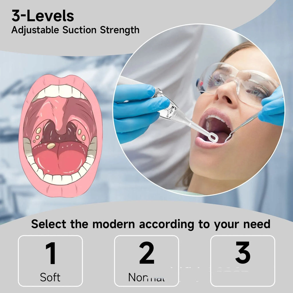 Milky white tonsil extractor oral cleaning tool for dental stones removal with 180g net weight