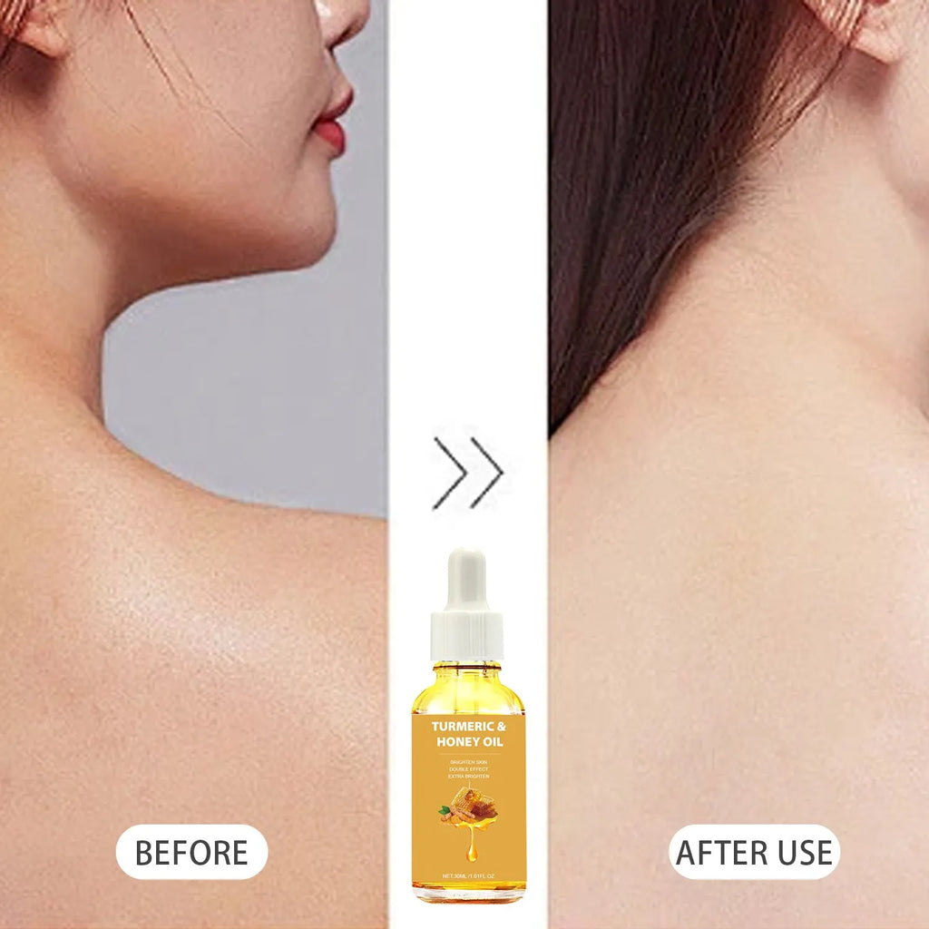 30ml turmeric honey essential oil in amber glass bottle with dropper for facial beauty applications