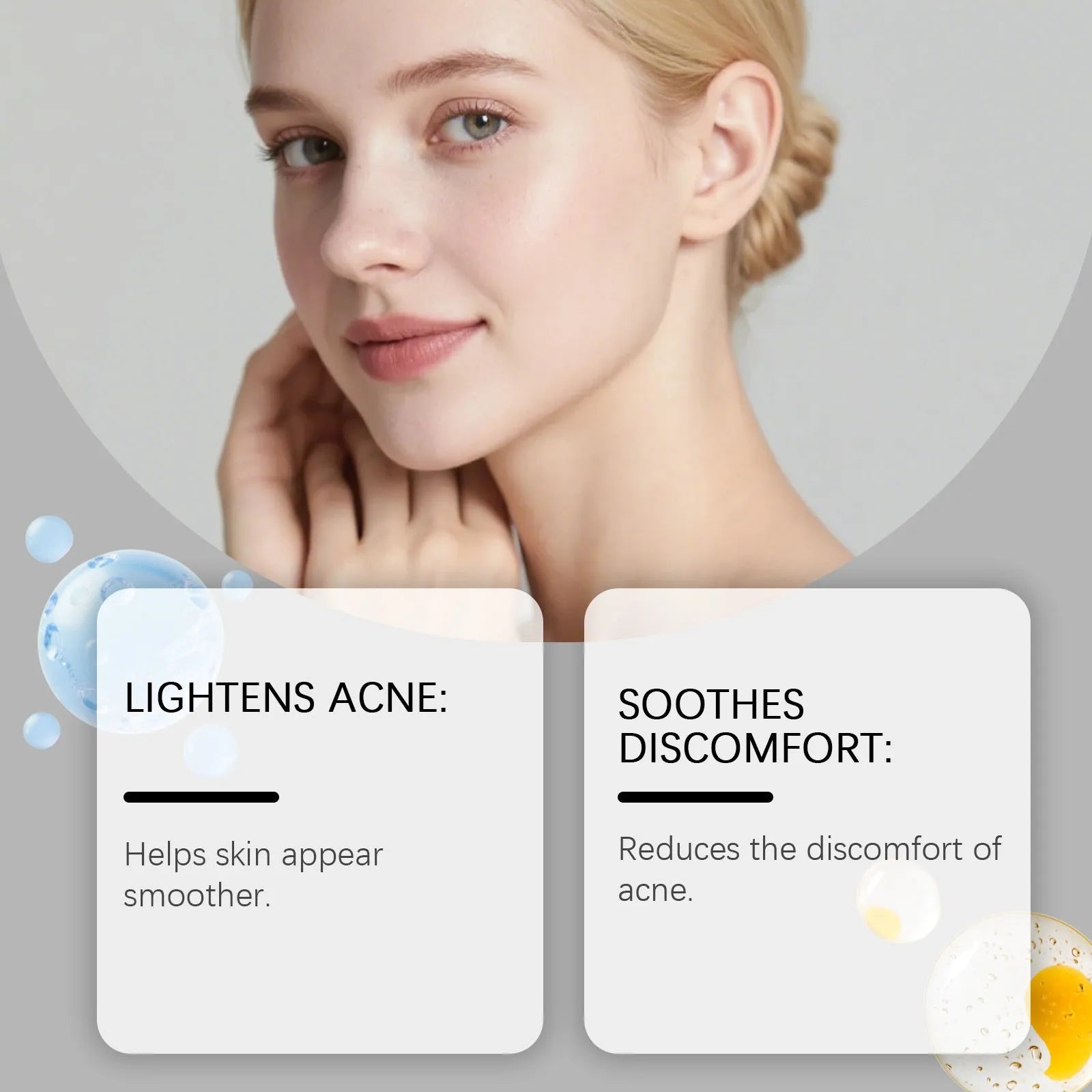 Transparent hydrocolloid acne patches in 80-count pack for facial blemish treatment