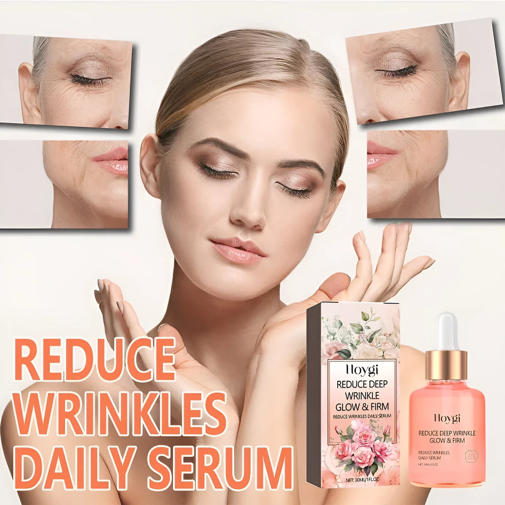 30ml rose essential oil bottle with dropper for facial skincare and wrinkle reduction