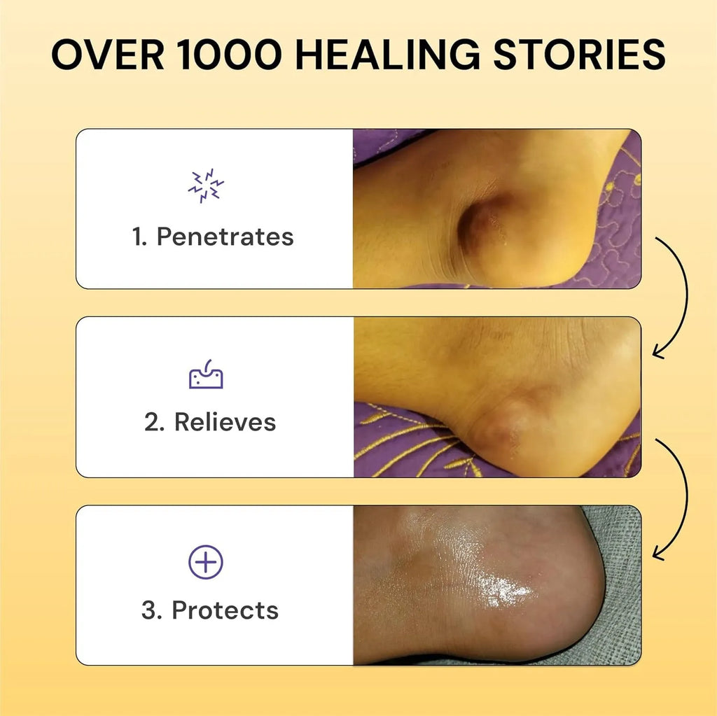 120g container of Flare Care topical analgesic cream for muscle and joint pain relief.